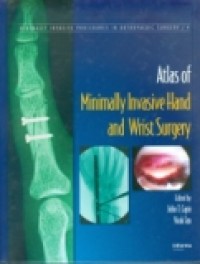 ATLAS OF MINIMALLY INVASIVE HAND AND WRIST SURGERY