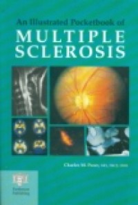 AN ILLUSTRATED POCKETBOOK OF MULTIPLE SCLEROSIS